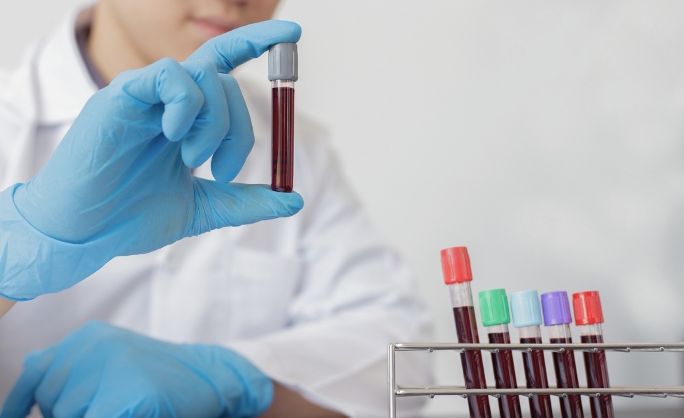 laborant analizujący jedną z sześciu próbek krwi do testów gęstości osocza