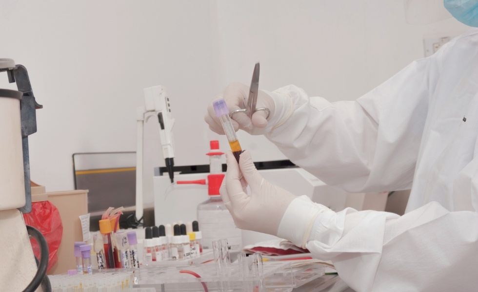 lekarz egzaminujący próbkę krwi pacjenta w celach analitycznych